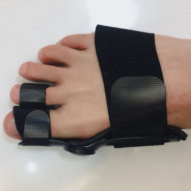 (日夜可用)hallux valgus 大拇指外翻加强拇外翻矫正器