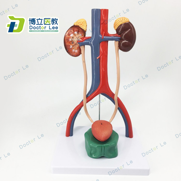 人体泌尿系统模型肾输尿管膀胱尿道解剖模型医学泌尿科 解剖模型