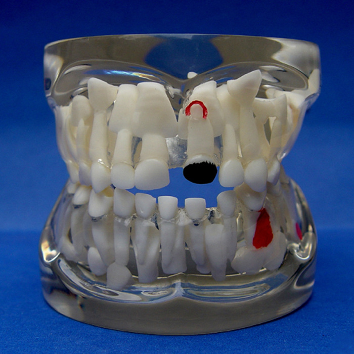 enovo颐诺儿童乳牙早期病态牙列模型牙齿发育幼儿牙齿护理教学具