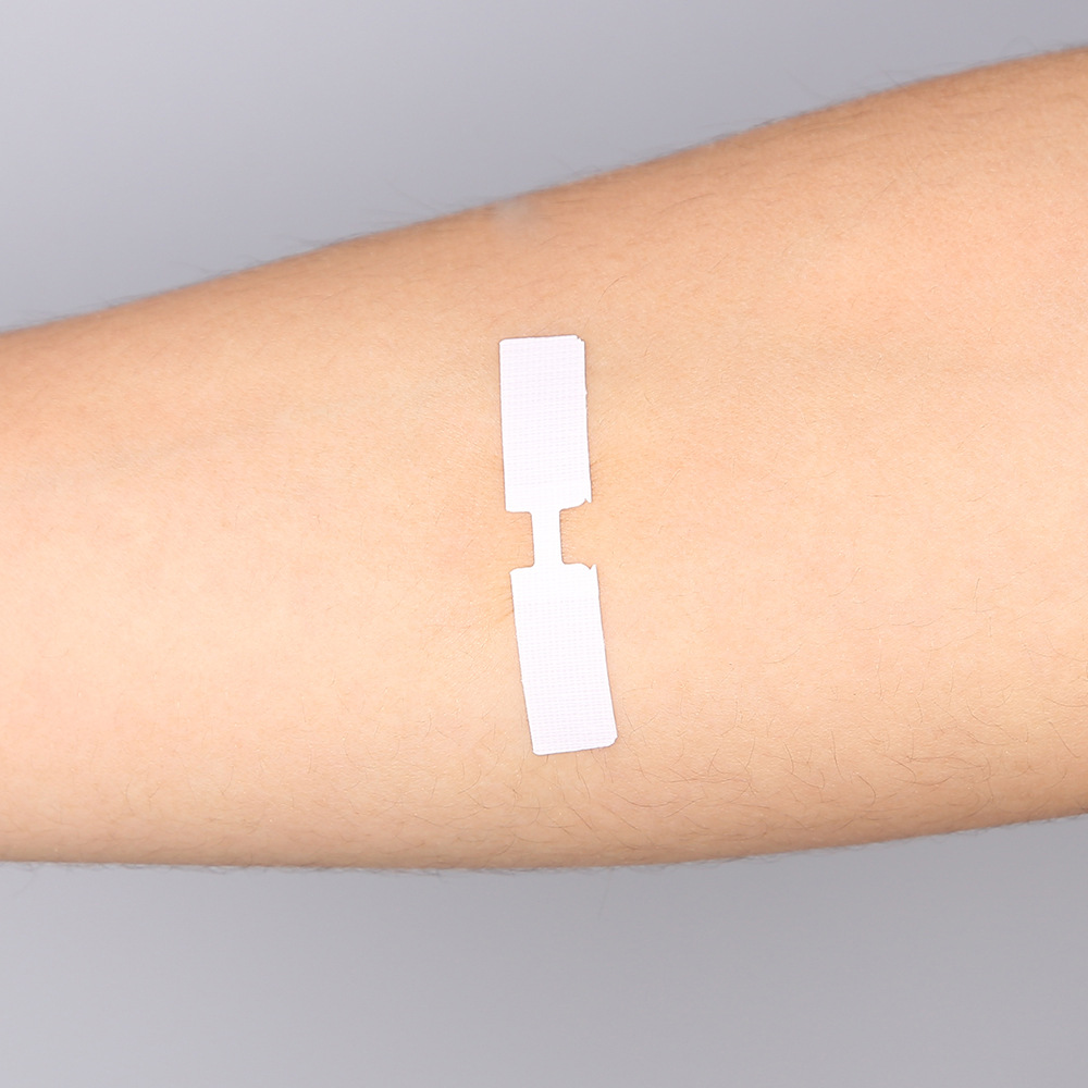 工厂新款户外快速无痛伤口免缝拉合缝合贴 无创伤免缝针拉合贴