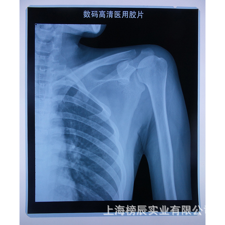 医用胶片10*12喷墨蓝片放射科dr cr ct打印胶片干式骨折牙科x光片