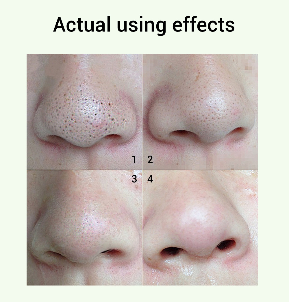 breylee pore refining serum 毛孔精华液(2号)17ml(非bpom)