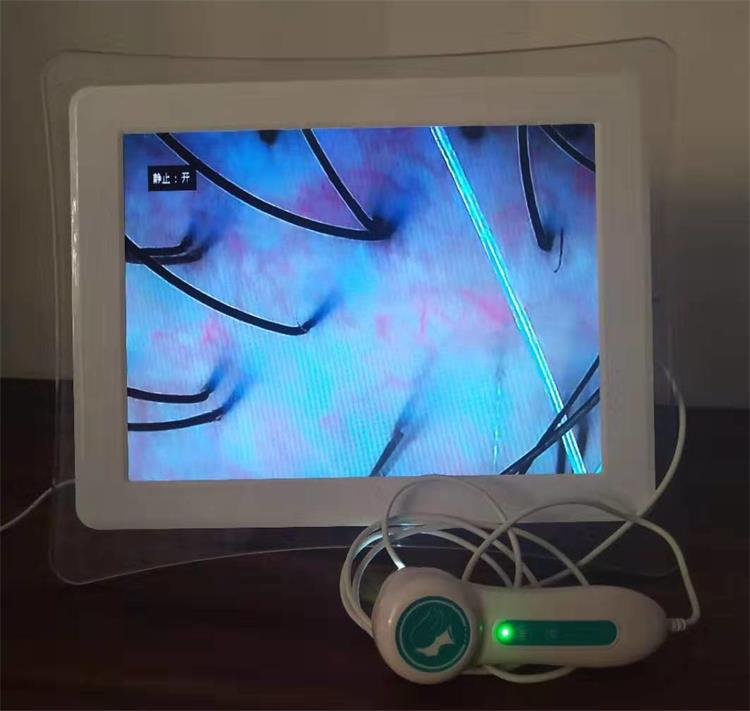 头皮检测仪配件毛孔堵塞红血丝三光谱测试头毛发皮肤毛囊检测头