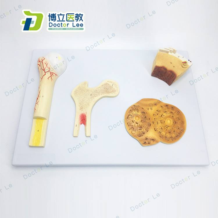 骨结构模型血管松质骨密质骨和股骨哈弗系统人体骨骼
