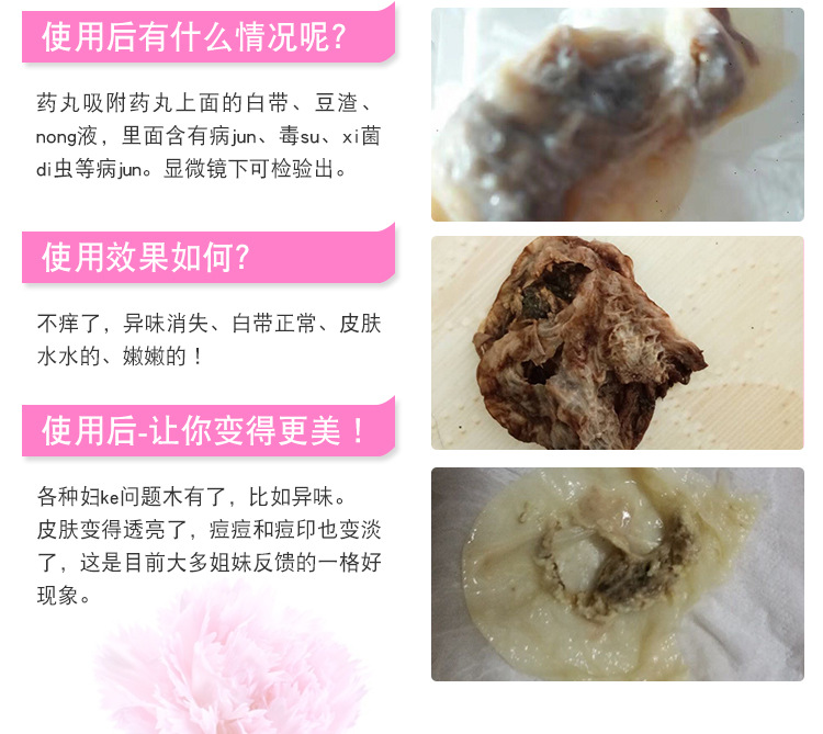 清宫拉线丸圣洁丹私密养巢女性私处清洁养阴丹可代发
