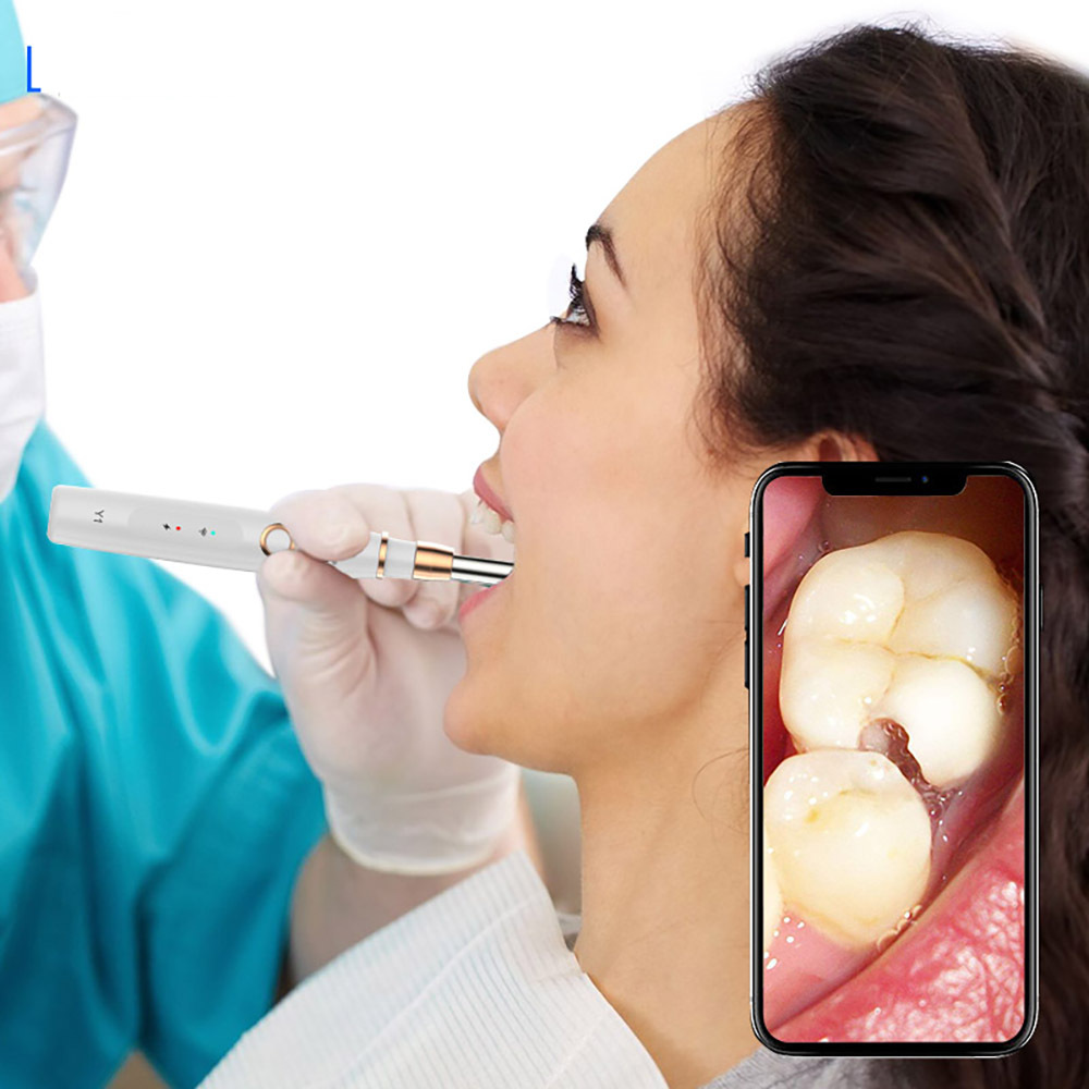 智能齿镜高清可视牙镜带灯口腔内窥镜牙齿内窥镜y1数码牙镜