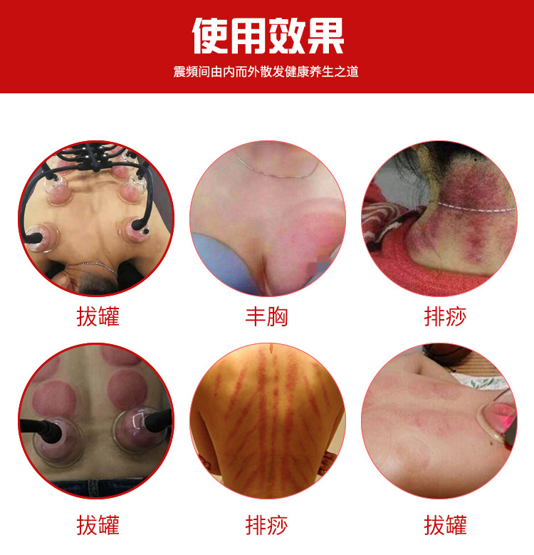 碧波家庭挺负压养生仪内在拔罐刮痧美容院丰胸按摩理疗仪器