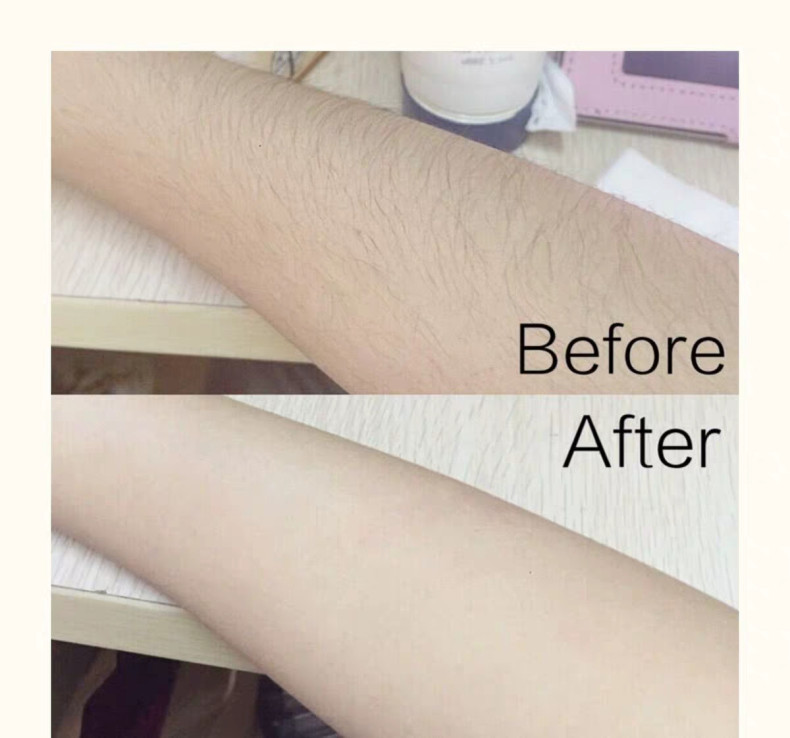 兰絮脱毛喷雾慕斯泡沫男女学生去手毛腿毛腋下腋毛全身温和脱毛膏