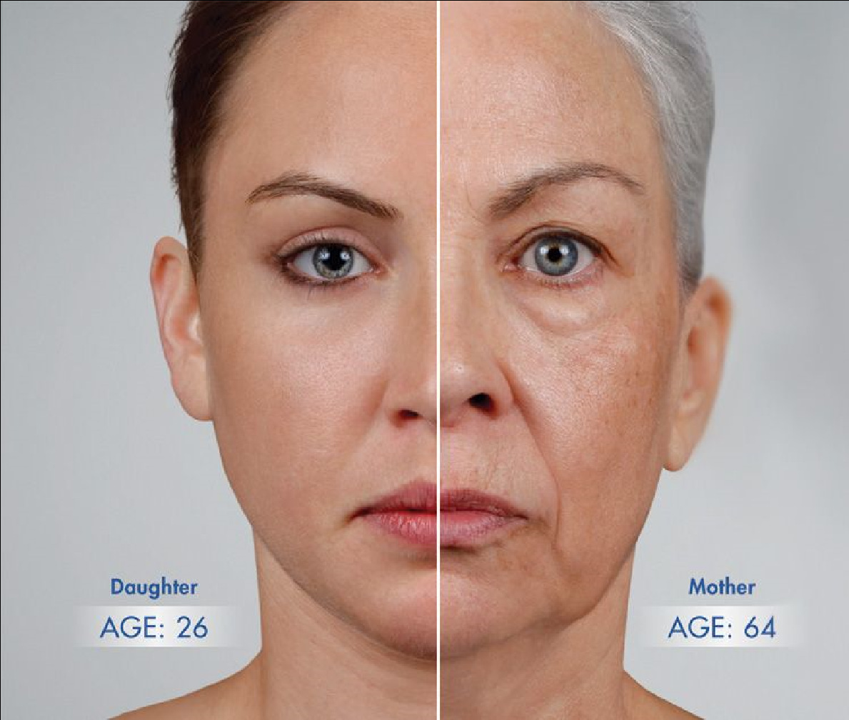 涨知识,自体脂肪丰脸颊需要多少脂肪,值得一看