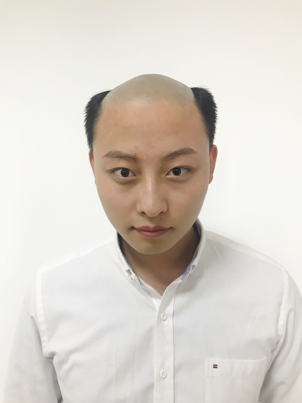 全手织真人假发男士头顶稀少补发块递针到边款遮白发增发补发