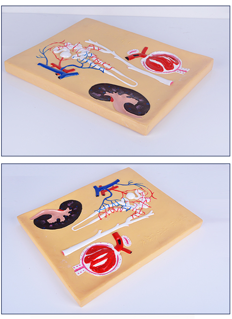 厂家直销 肾单位,肾小体模型 无味塑料 pvc制作 生物教学仪器