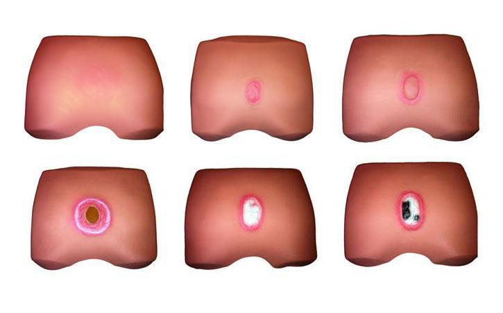 高级女性膀胱穿刺模型