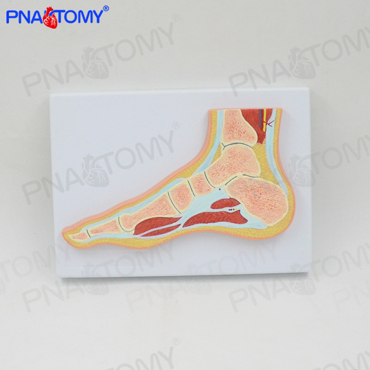 人体mri脚关节骨骼肌肉剖面构造解剖模型医学骨科疼痛科教学标本