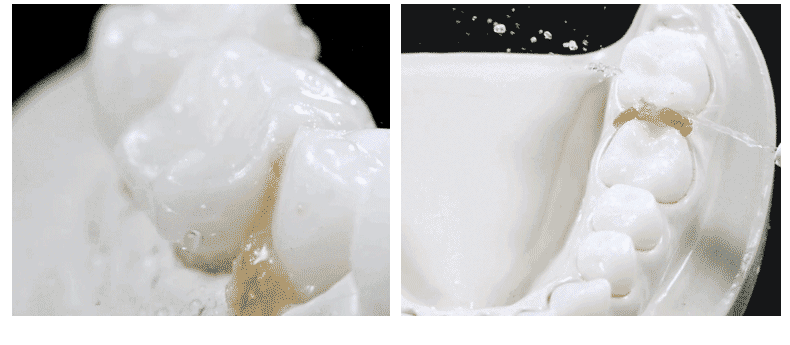 松下冲牙器家用电动口腔冲洗器正畸洗牙器便携式机水牙线ew-adj4