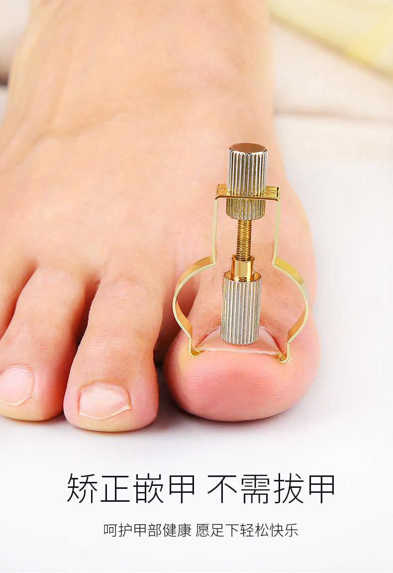 甲沟矫正器嵌甲脚指甲钳修甲套装修脚刀工具甲勺指卷甲卷矫正器炎