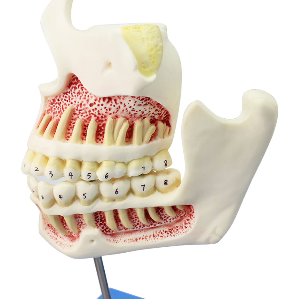 医信牙与颌骨的发育模型牙齿病变模型牙齿模型