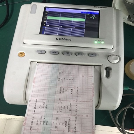 科曼胎心监护仪star5000e胎儿监护仪