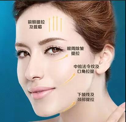 线雕大v线提升面部颧骨变宽了怎么办?