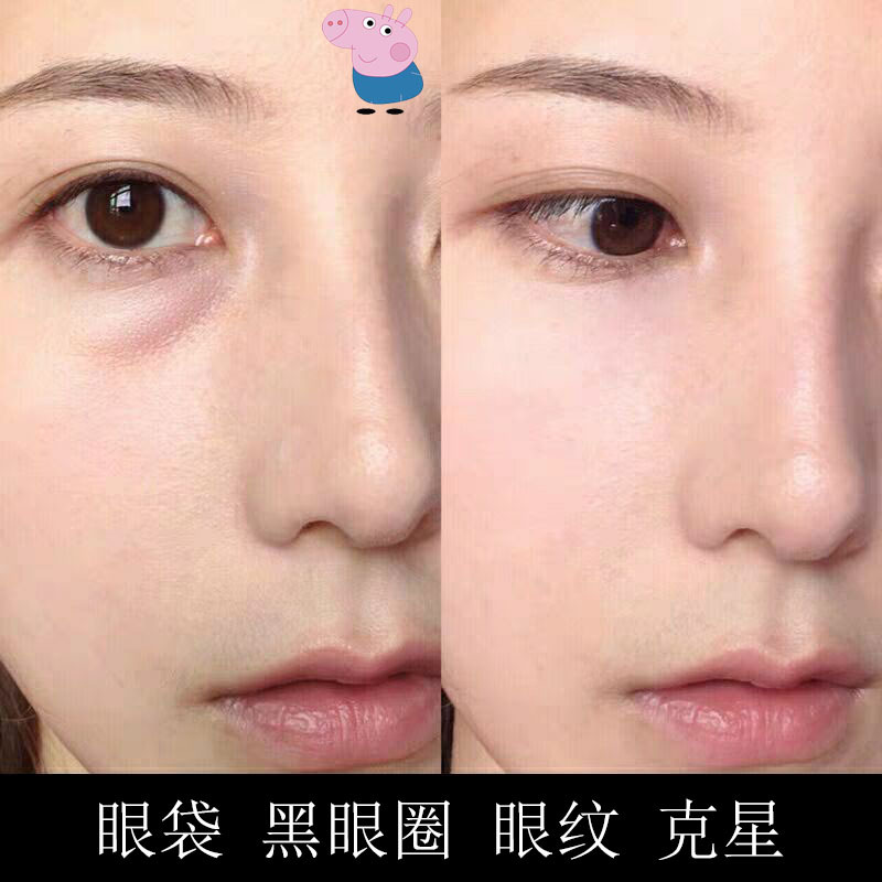 眼霜淡化黑眼圈眼袋细纹紧致提拉抗皱补水保湿细纹提拉眼角厂家