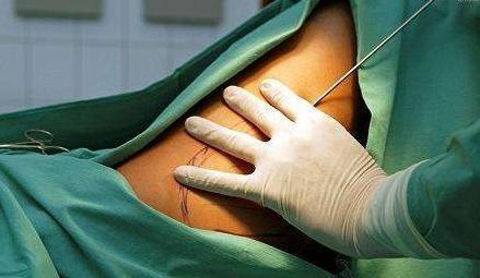 快速减脂,怎样才能快速减肥,肥胖的源头之4类减肥方法&