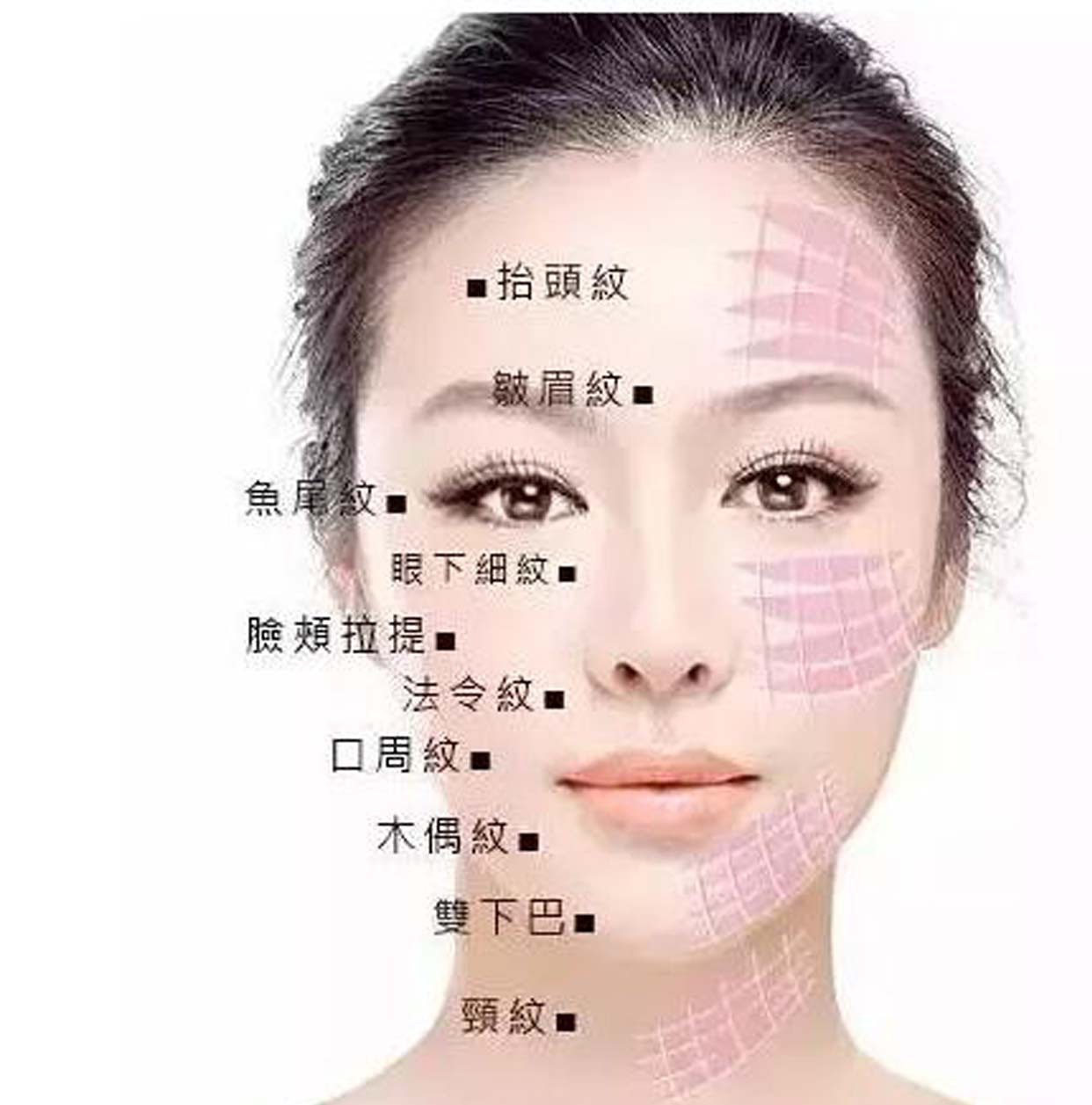 脸部微雕副作用多吗?