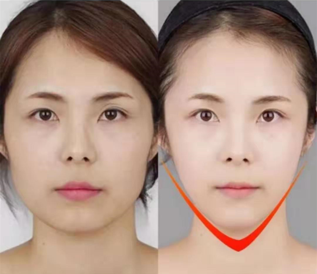 抖音挂耳双v脸面膜 提拉紧致v脸贴oem加工贴牌