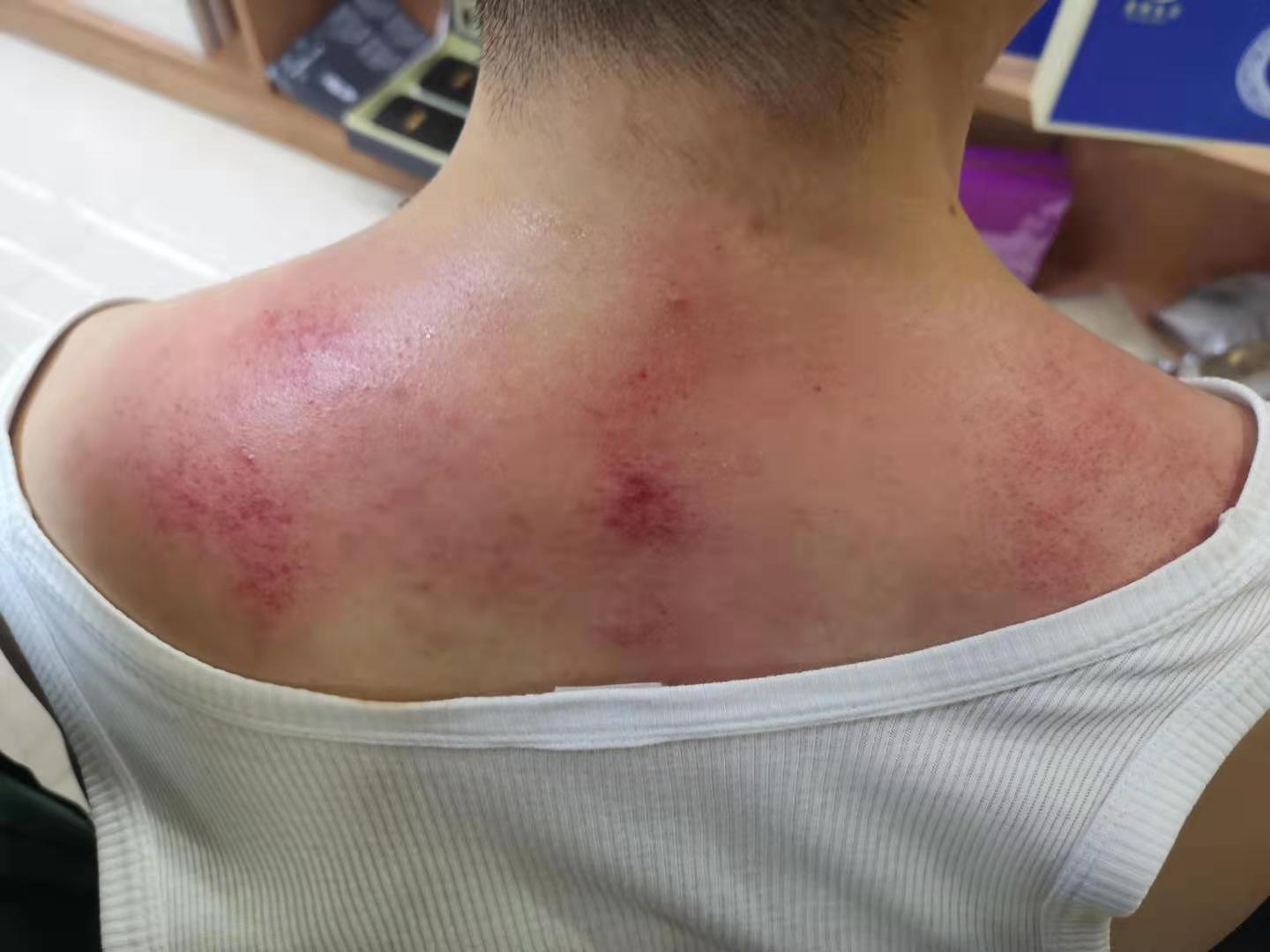 伊兰名香小黄姜精华乳出痧快砭石按摩疏通经络肩颈腰部四肢