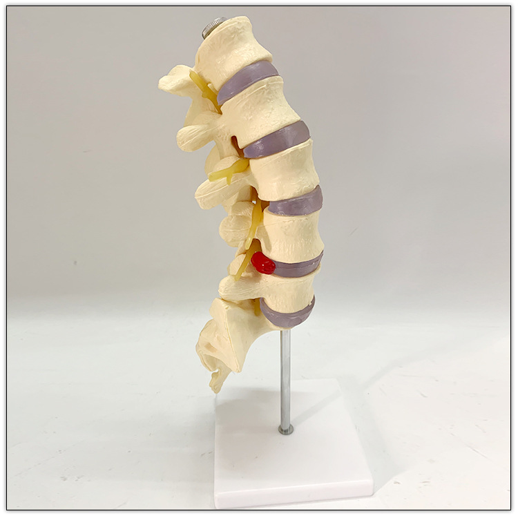腰椎1一5截图高清模型图片