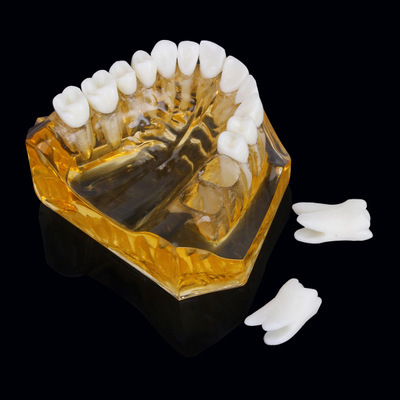 口腔教学模型下两半透明树脂水晶黄色牙模标准型成人牙模可拆卸上