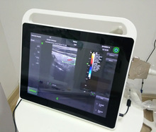 C3全数字彩色多普勒超声诊断仪便携式彩色超声 彩超