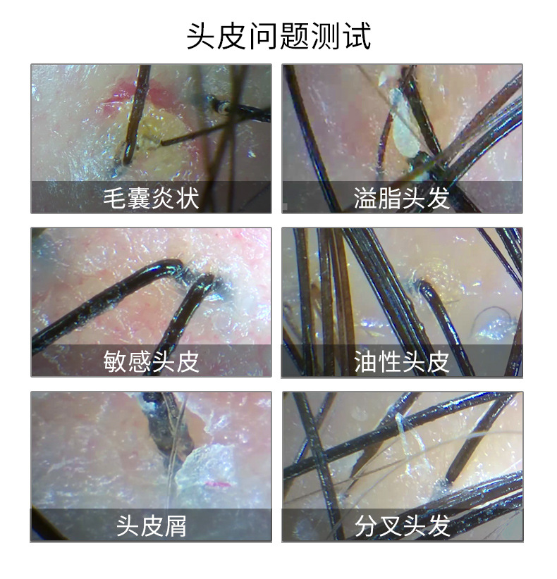 无线头皮毛囊毛发检测仪高清检查仪器连接手机头发皮肤测试仪脸部