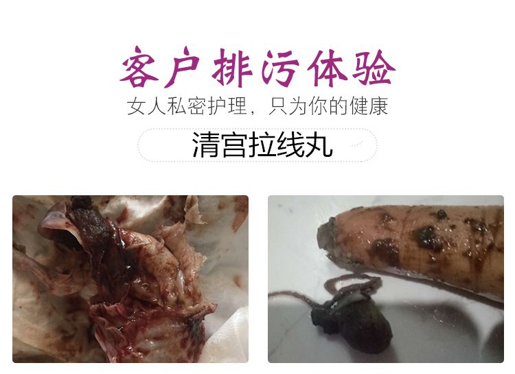 清宫丸排出像肉块图片