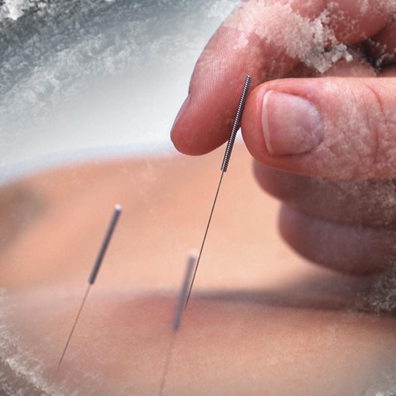 包邮世界环球针灸针一次性无菌 医用 家用毫针非银针带套管500支