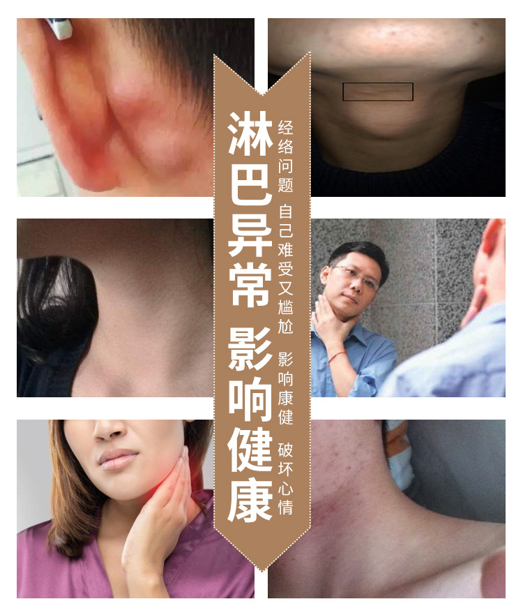 专业厂家生产膏药可oem特效淋巴通络贴黑膏药贴黑膏药加工批发