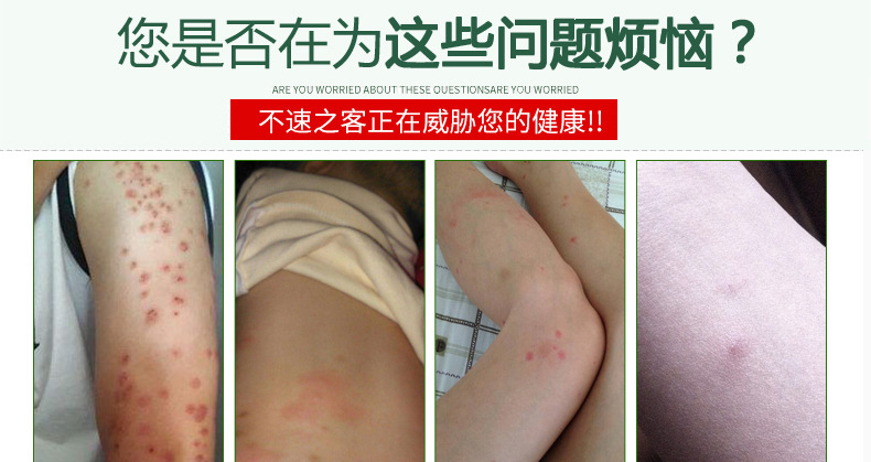 包邮臭虫药杀虫剂灭跳蚤虱子臭虫克星去除吸血虫净粉家用床上杀虫