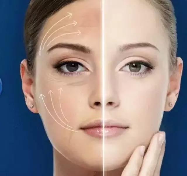 蛋白线面部提升图片看完后,你还觉得大v线雕副作用没什么吗?