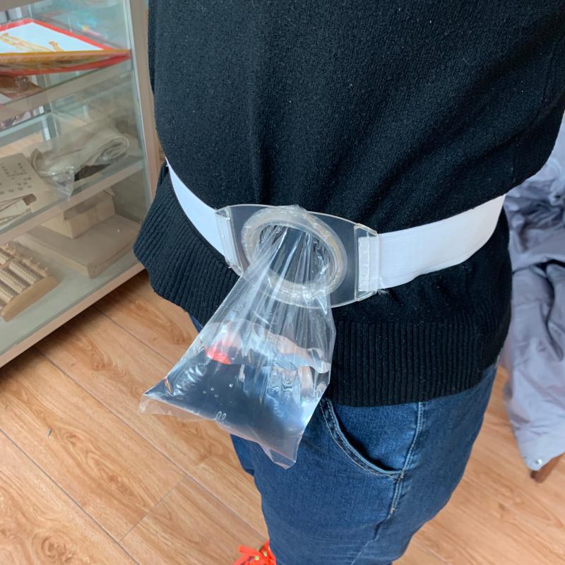 包邮硅胶腰带式造口袋造瘘袋假肛接便器非一件式粘贴一次性肛门袋