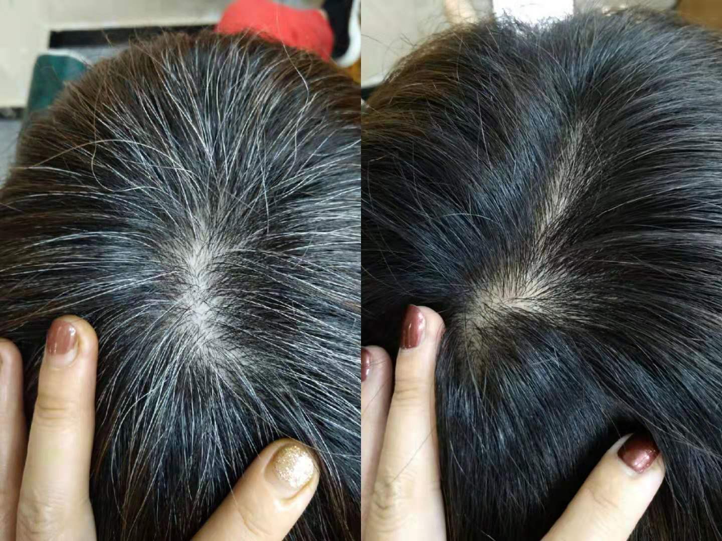 厂家oen植物首乌黑发营养液原料黑桑果黑发乌发液护理液