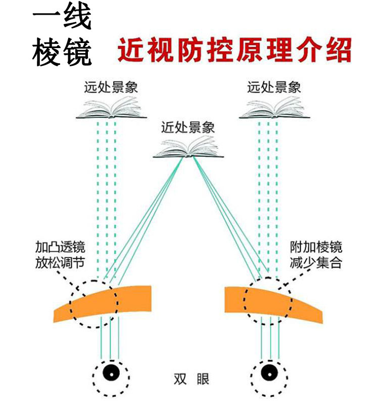 一线棱镜双光中子镜青少年防控三棱镜近视预防