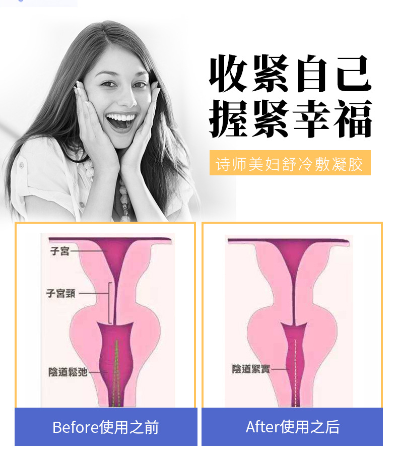 诗师美厂家现货女性私处护理凝胶妇科产品缩阴紧致产后修复保养药