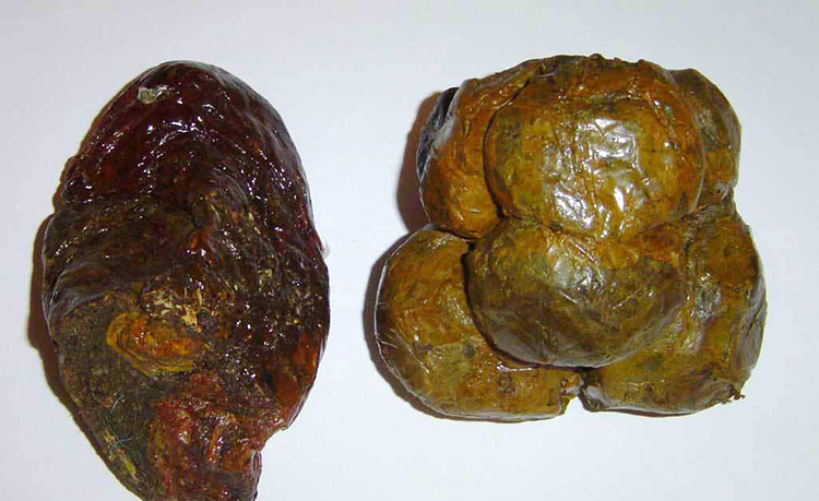 蜂农自产自销蜂胶 毛胶蜂胶不含重金属泡酒用 散装蜂胶1000g