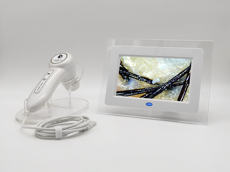 三光谱头皮检测仪 7寸屏毛发检测 皮肤检测 高清毛囊检测工厂直销