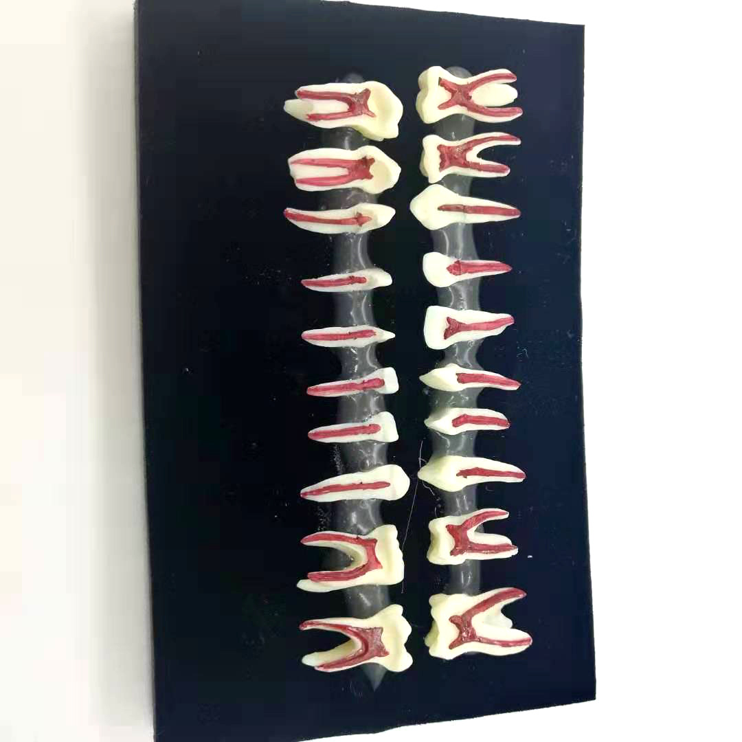 儿童牙齿剖面模型 医患沟通乳牙牙粒医患沟通演示 口腔乳牙