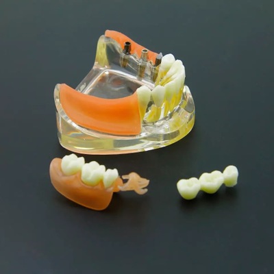 牙科口腔教学模型下颌牙种植修复可摘卸义齿演示模型假牙可拆卸