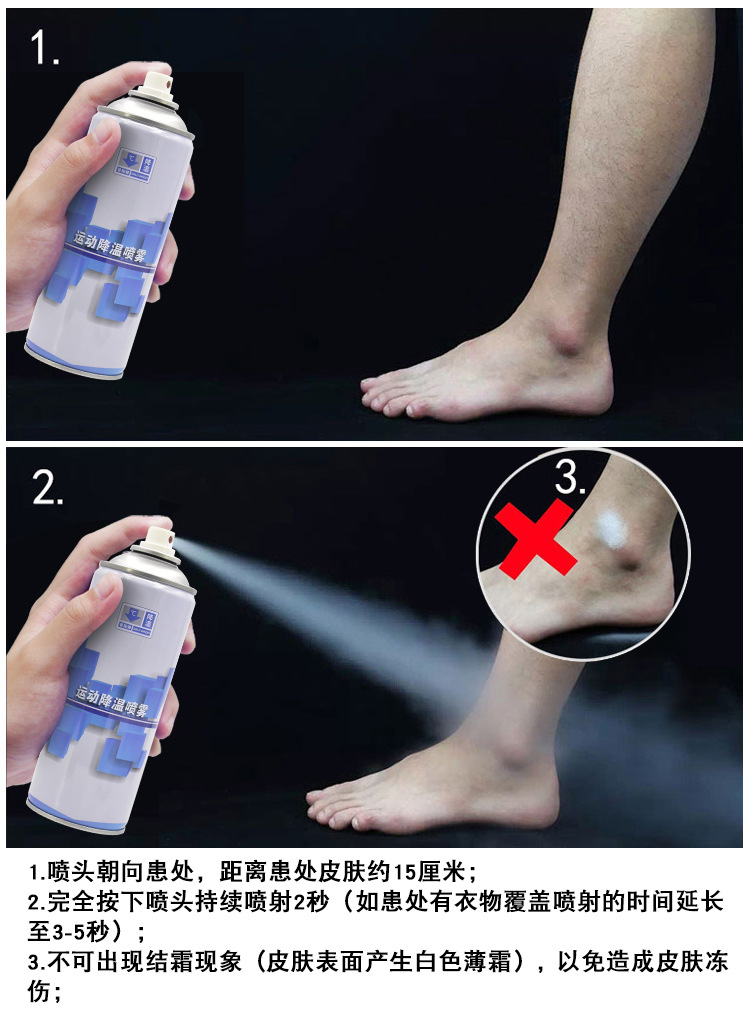 普施健冷喷运动降温喷雾剂足球冷冻喷剂崴脚冷敷扭伤冰敷肌肉撞伤