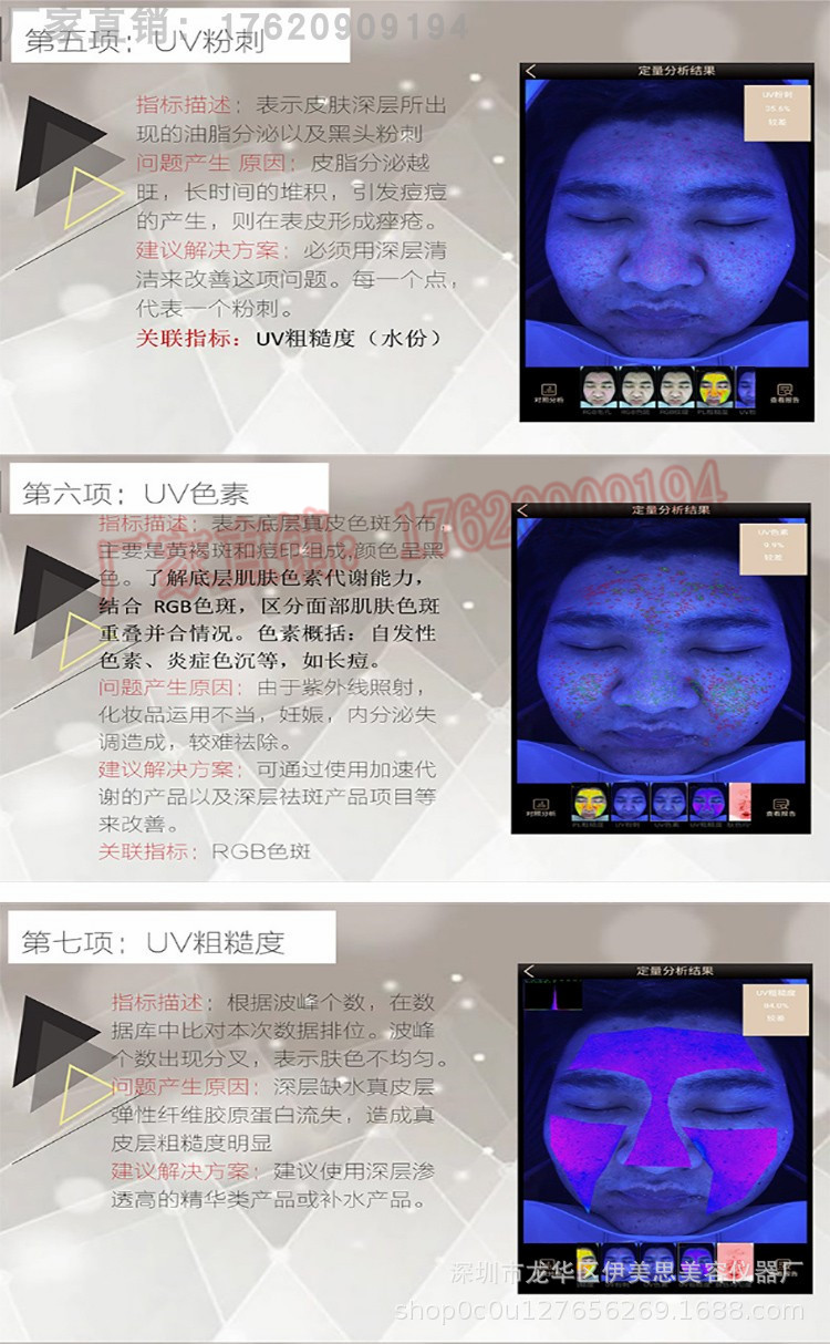 魔镜新款皮肤检测仪m9面部分析检测皮肤十年衰老症状美容院拓客