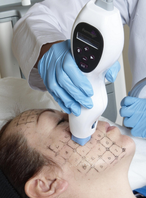 500元做热玛吉?你在逗我?