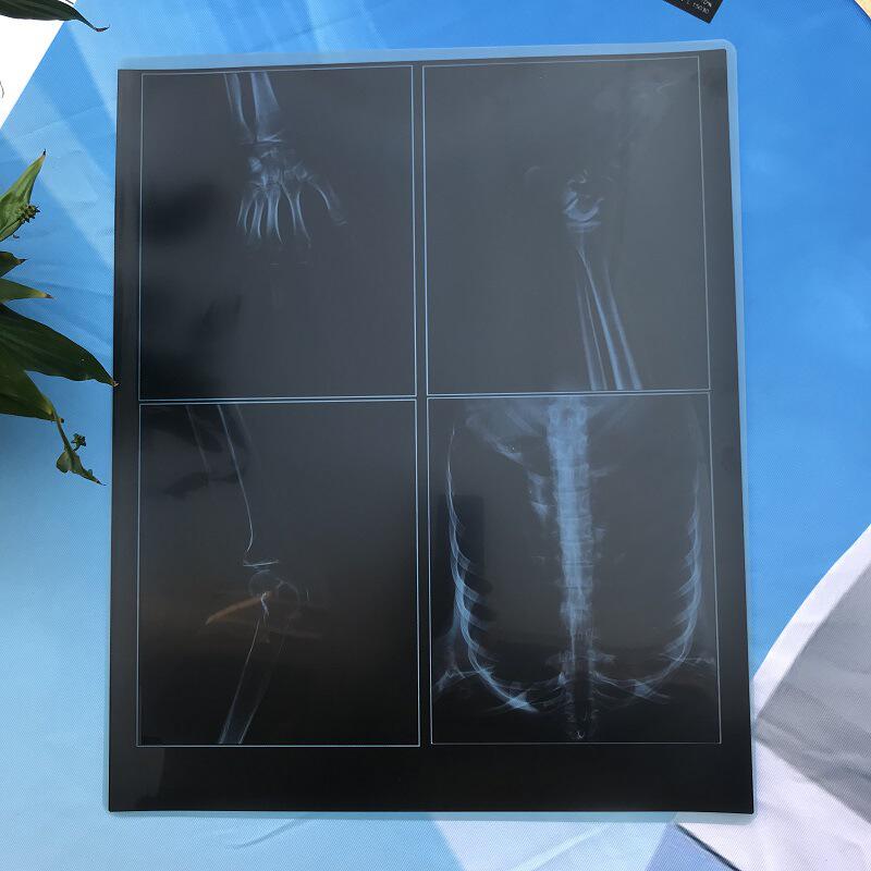 [小额批发]放射科ct热敏胶片14*17[1件包邮]