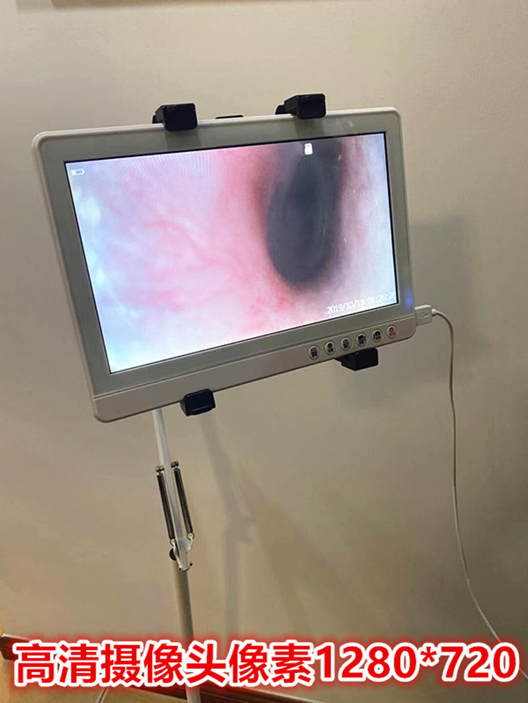 1寸高清可视耳镜采耳工具支架耳鼻喉可视镜内窥镜儿童掏耳