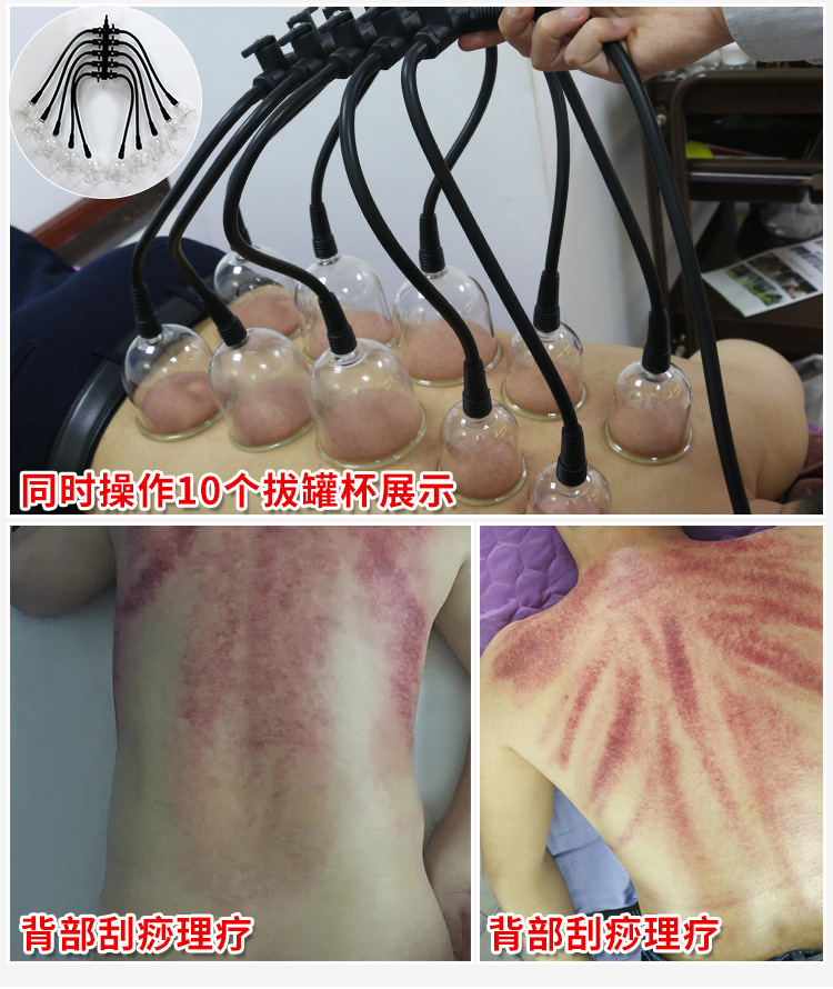 负压*仪器家用胸部按摩器 美容院调理仪 拔罐刮痧理疗养生仪器